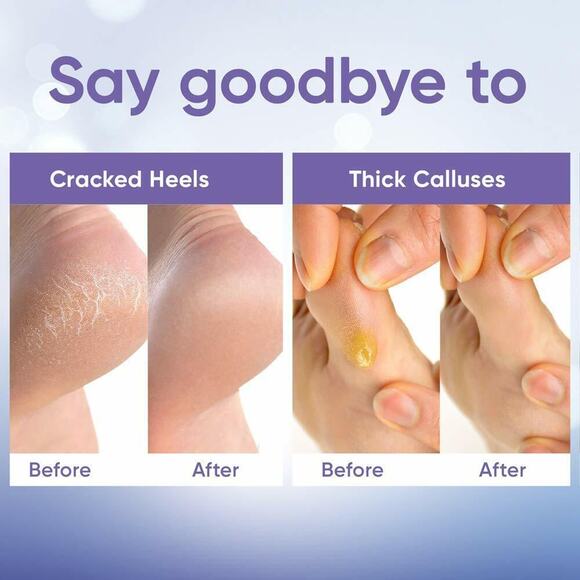 2 Pairs Exfoliating Peel Off Foot Mask Remove Hard Dead Skin Callus Soft Feet - Picture 2 of 9